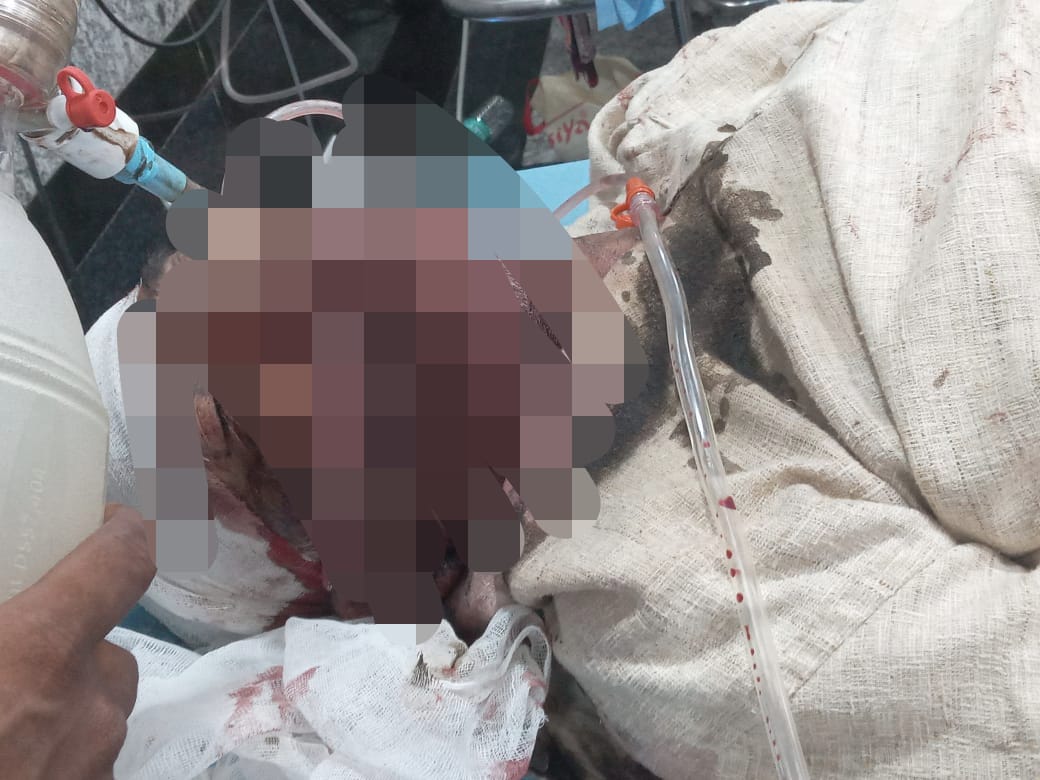 तेज रफ्तार कार का कहर — चाचा की मौत, भतीजा गंभीर, परिवार में मचा कोहराम